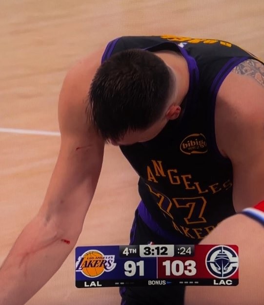 九游娱乐-谁抓的~东契奇罚球时看向手臂 好几道伤口&amp;血迹斑斑